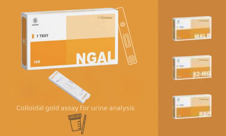 Urinalysis Test Kits for Renal Disease